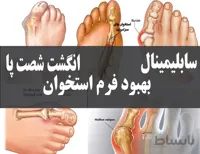 دانلود فایل سابلیمینال بهبود فرم استخوان انگشت شصت