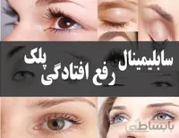 دانلود فایل سابلیمینال رفع افتادگی پلک | فاپول