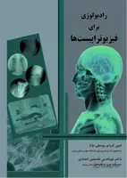 رادیولوژی برای فیزیوتراپیست ها