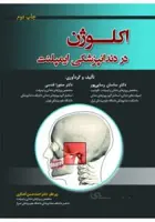 اکلوژن در دندانپزشکی ایمپلنت