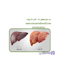 پک اقتصادی کبدچرب نیوشا