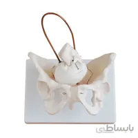 مولاژ لگن با نمایش چرخش سر نوزاد