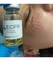 کوکتل میکرونیدلینگ دور چشم توسکانی TOSKANI ECPR