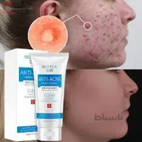 فوم ضد جوش و آکنه بئوتوا ا Anti acne