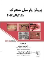پروتز پارسیل متحرک مک کراکن ۲۰۱۶
