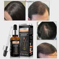 سرم موی رشد مجدد موتقویتی و گیاهی اورجینال