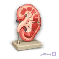 مولاژ کلیه ایستاده