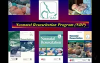 وبینار احیای نوزاد (NRP)