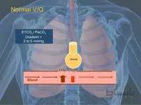 وبینار پایش های تنفسی در بیماران کووید۱۹(Respiratory Monitoring in COVID-19 Patients)
