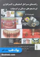 راهنمای مراحل کلینیکی و لابراتواری اوردنچرهای متکی بر ایمپلنت