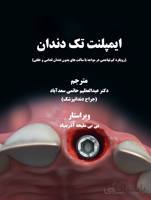 ایمپلنت تک دندان ۲۰۲۰