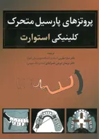 پروتزهای پارسیل متحرک کلینیکی استوارت
