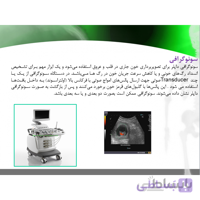 پاورپوینت آماده اثر سونوگرافی داپلر در تشخیص گرفتگی عروق