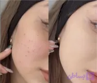 ⭕️پنکک گابرینی ⭕️اورجینال (محصول ترکیه) ☑️