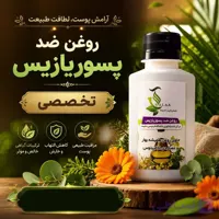 روغن ضد پسوریازیس | درمانی | کاملا طبیعی