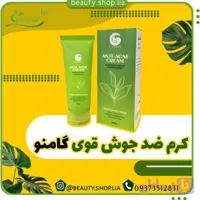 کرم آنتی آکنه