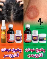 پکیج کامل گیاهی درمان قارچ سر و بدن آذین