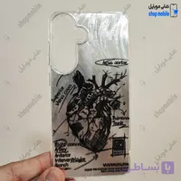 قاب گوشی سامسونگ گلکسی S25 FE (کاور IMD براش طرح آناتومی قلب Silver)
