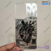 قاب گوشی شیائومی ردمی نوت 11 پرو پلاس (کاور IMD براش طرح آناتومی قلب Silver)