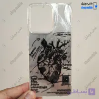 قاب گوشی شیائومی ردمی نوت 14 پرو 5G / نوت 14 پرو پلاس / پوکو X7 (کاور IMD براش طرح آناتومی قلب Silver)