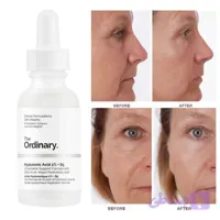 سرم دی اوردینری مدل Hyaluronic Acid