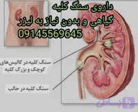 داروی سنگ کلیه