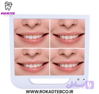 مانیتور و دوربین داخل دهانی