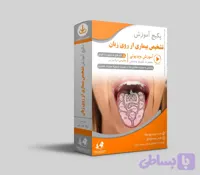 آموزش تشخیص بیماری از روی زبان