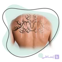 آموزش مجازی پاک کردن تاتو بدن |جلسه ۵