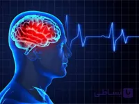 دانلود پوستر مدیریت سکته مغزی حاد (کد 724) گایدلاین 2026
