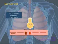 دانلود اسلایدها و پادکست های وبینار پایش های تنفسی در بیماران کووید۱۹(Respiratory Monitoring in COVID-19 Patients)