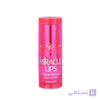 رژ لب حرارتی ژله ای گلدن رز Golden rose مدل Miracle Lips شماره101 رنگ Berry Pink