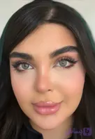 لنز چشم رنگی طبی موناکو