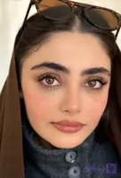 لنز رنگی طبی مسینا(عسلی قهوه ای شکلاتی)
