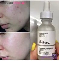 سرم نیاسانامید اوردینری اصل با حجم 30گرم