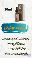 سرم ضد جوش و از بین بردنده جوش اکنه