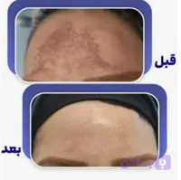 کرم معجزه اصل(mojezeh)