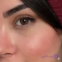 لنز طبی رنگی رز قهوه ای عسلی دور دار Orkid Brown