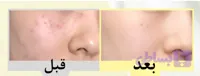 ترمیم کننده دکتر آلتیا۳۴۵
