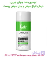 لوسیون ضد جوش اورین