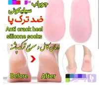 جوراب ژله ای، درمان ترک پا، میخچه، نتیجه عالی😍
