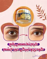 کرم رفع گودی و تیرگی و مراقبت دور  چشم اذین