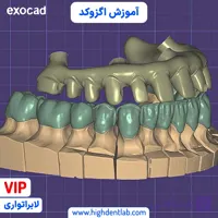 آموزش اگزوکد (دندانسازی دیجیتال)