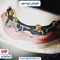 آموزش اوردنچر