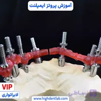 آموزش پروتز ایمپلنت