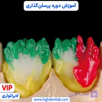 آموزش دوره پرسلن‌ گذاری