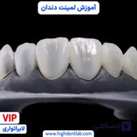 آموزش لمینت دندان