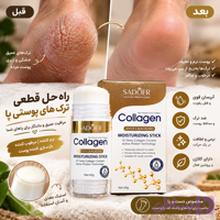 استیک مرطوب کننده دست و پای سادور| رفع خشکی و ترکهای پوستی|حاویه کلاژن