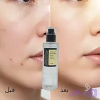 اسنس ترمیم کننده حلزون 96 کوزارکس | ترمیم پوست و محو کننده جوش